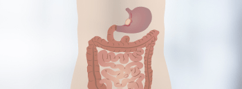 Cirugía oncológica gastrointestinal